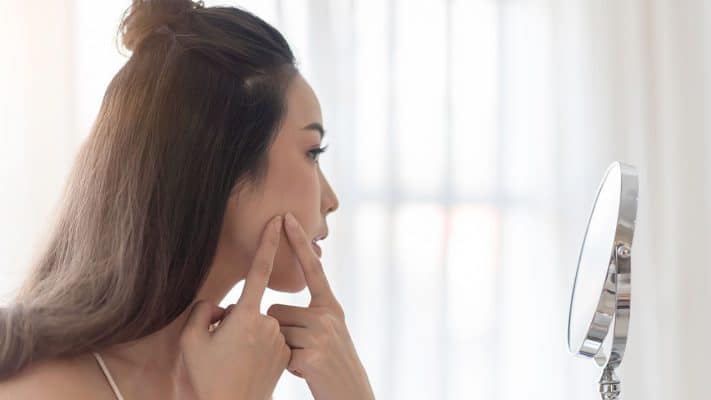 fungal acne treatment